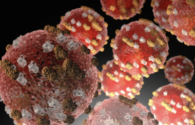 Pennsylvania Measles Outbreak Tops 800 Cases as Spread Accelerates