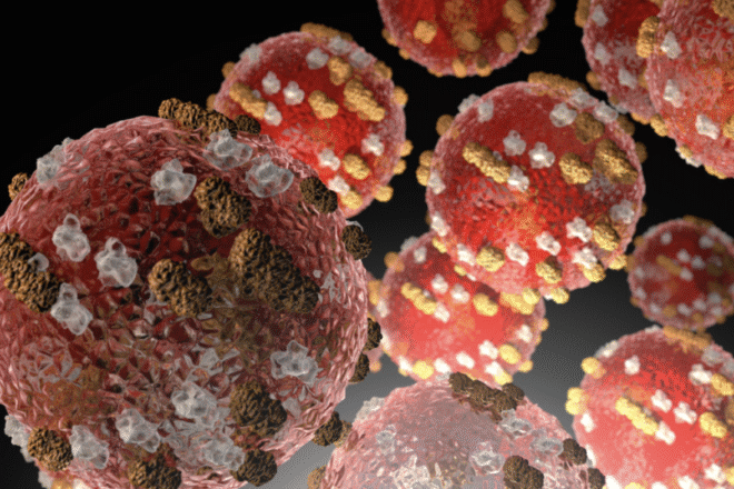 Pennsylvania Measles Outbreak Tops 800 Cases as Spread Accelerates