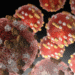 Measles